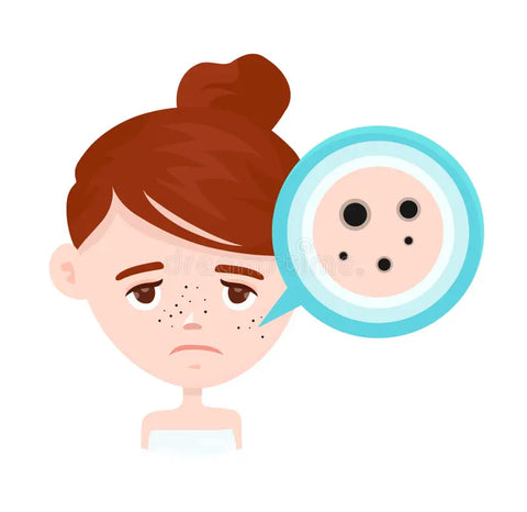 Dark Spots